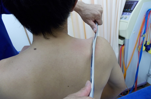 術後の挫傷痕(皮膚の赤み)について
